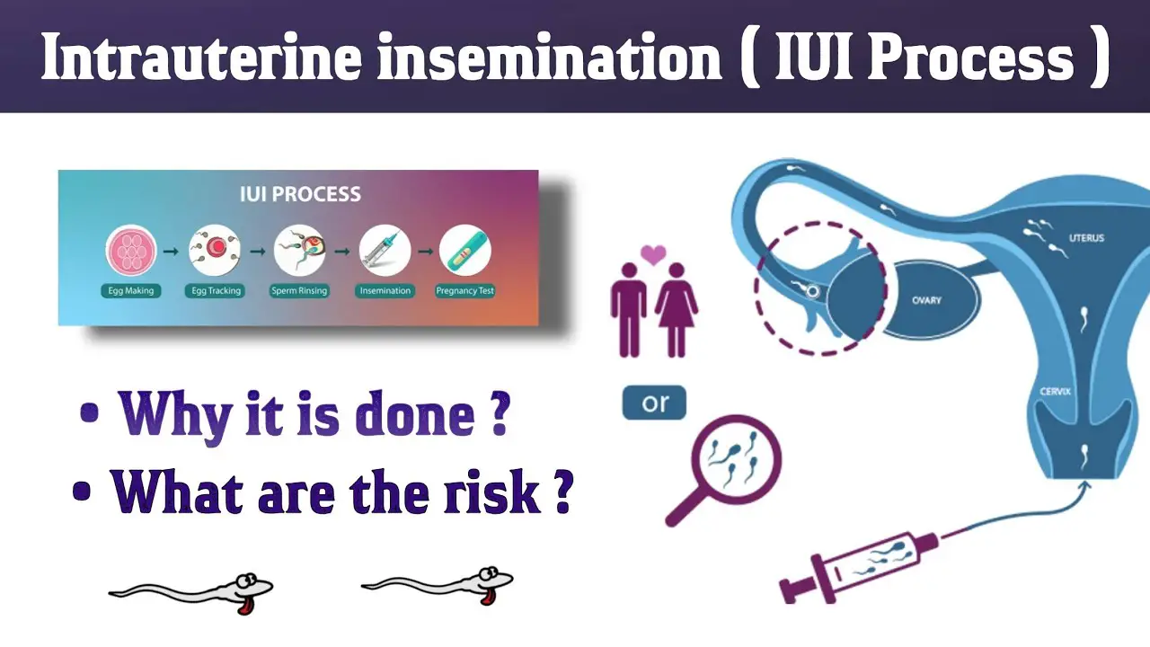 Intrauterine Insemination